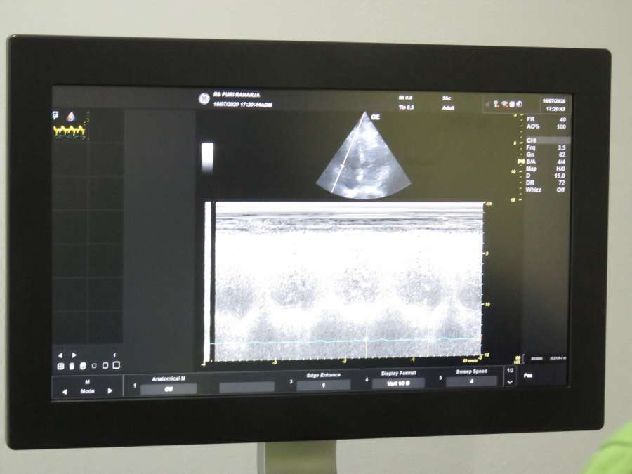 Echocardiography